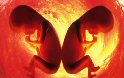 三代试管移植双胎应该如何控制？三代试管移植双胞胎有风险吗？