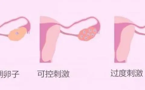 做试管婴儿到底需要多少卵子?做试管婴儿如何测算卵子的利用率呢