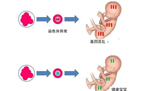PGS对高龄孕妇习惯性流产、反复试管失败有帮助吗？