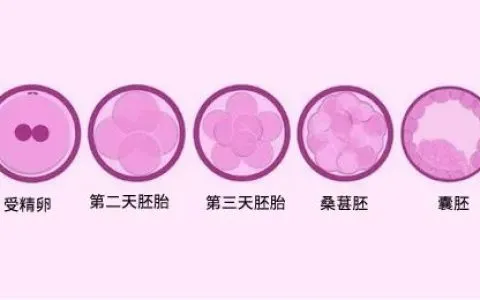 试管婴儿胚胎移植到底是选择单还是双？做试管婴儿为何提倡采用选择性单囊胚移植?
