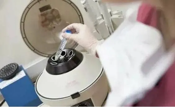 在进行试管婴儿移植前需要满足哪些条件？哪些人才能做试管婴儿，试管婴儿才适合他？
