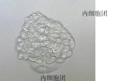 试管移植囊胚会有生双胞胎的可能吗？移植一个囊胚生双胞胎的几率如何？