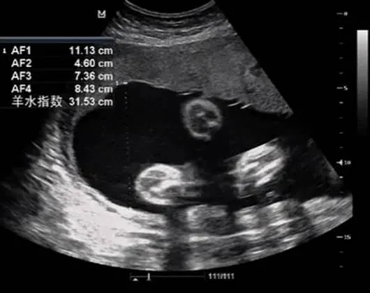 什么是基因芯片检测？基因芯片检测在试管婴儿中的应用有哪些？如何通过基因芯片检测提高试管婴儿的成功率？