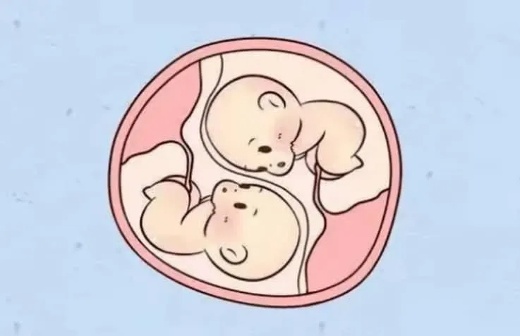 什么是减胎？试管婴儿怀上双胎后为什么要减胎？哪些人做试管后需要减胎?