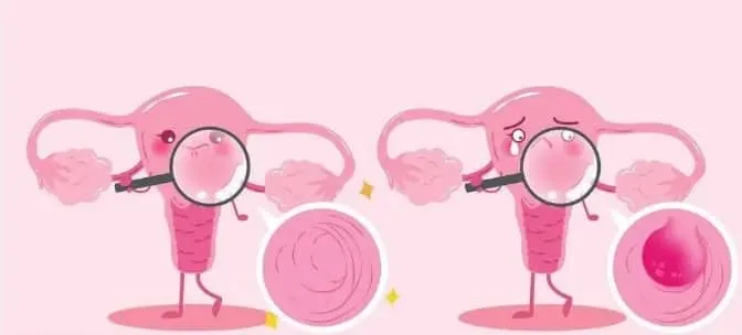 子宫内膜厚度怎么查？什么样的子宫内膜有利于怀孕？试管婴儿中什么样的子宫内膜条件最有利于胚胎着床？