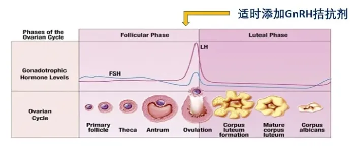 高龄女性做试管婴儿如何选择合适的促排方案？高龄女性试管成功的关键是什么？