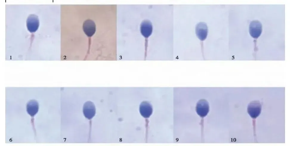 什么样的精子才算健康？精子形态异常会影响怀孕吗？备孕男性必看！