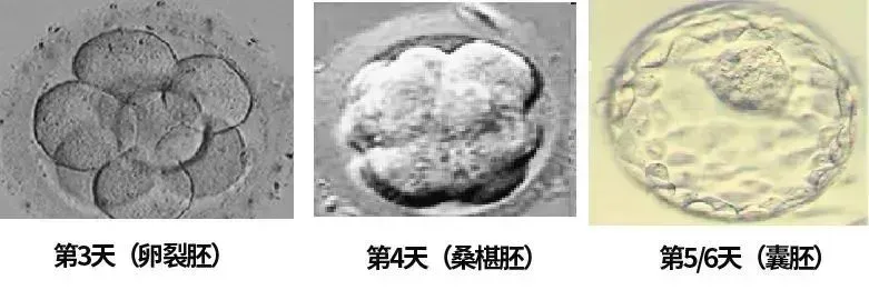 试管婴儿囊胚评级4BB和3AC有何区别？备孕家庭如何判断优劣？