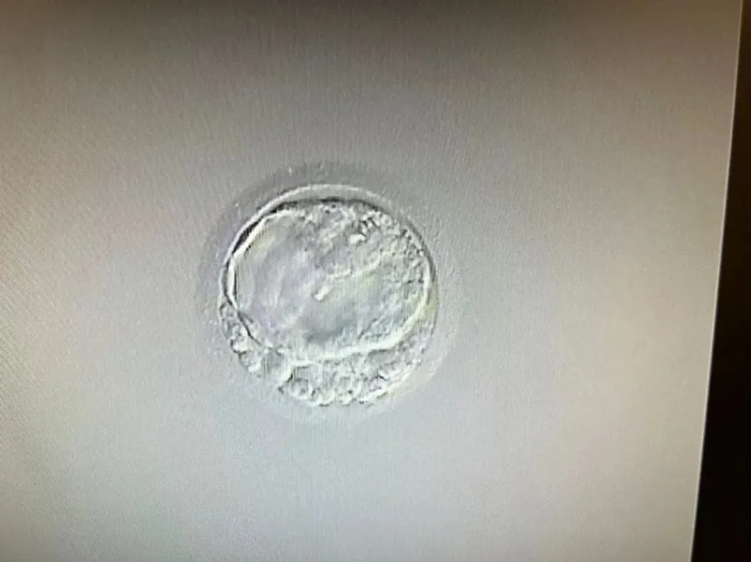 高龄做试管婴儿很难成功？比起提高怀孕率，高龄试管婴儿人群做好这点更重要！