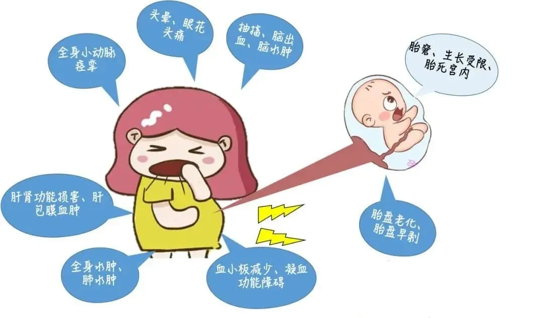 什么是先兆子痫? 先兆子痫对胎儿的危害有哪些？高风险人群如何进行后续干预先兆子痫？