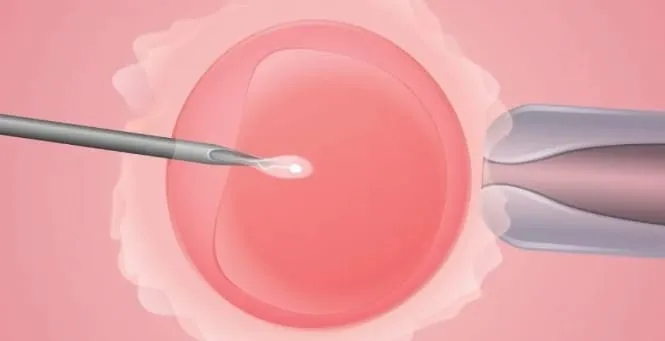 高龄女性的生育阻力究竟有哪些？试管婴儿技术如何帮助高龄女性提高生育成功率？