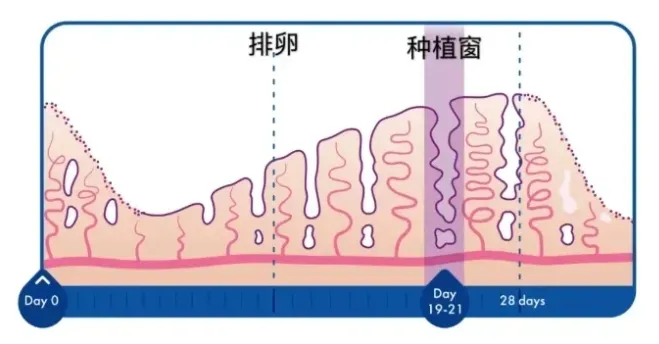 试管婴儿冻胚移植的内膜准备方案有哪几种？你适合哪一种冻胚移植的内膜准备方案？