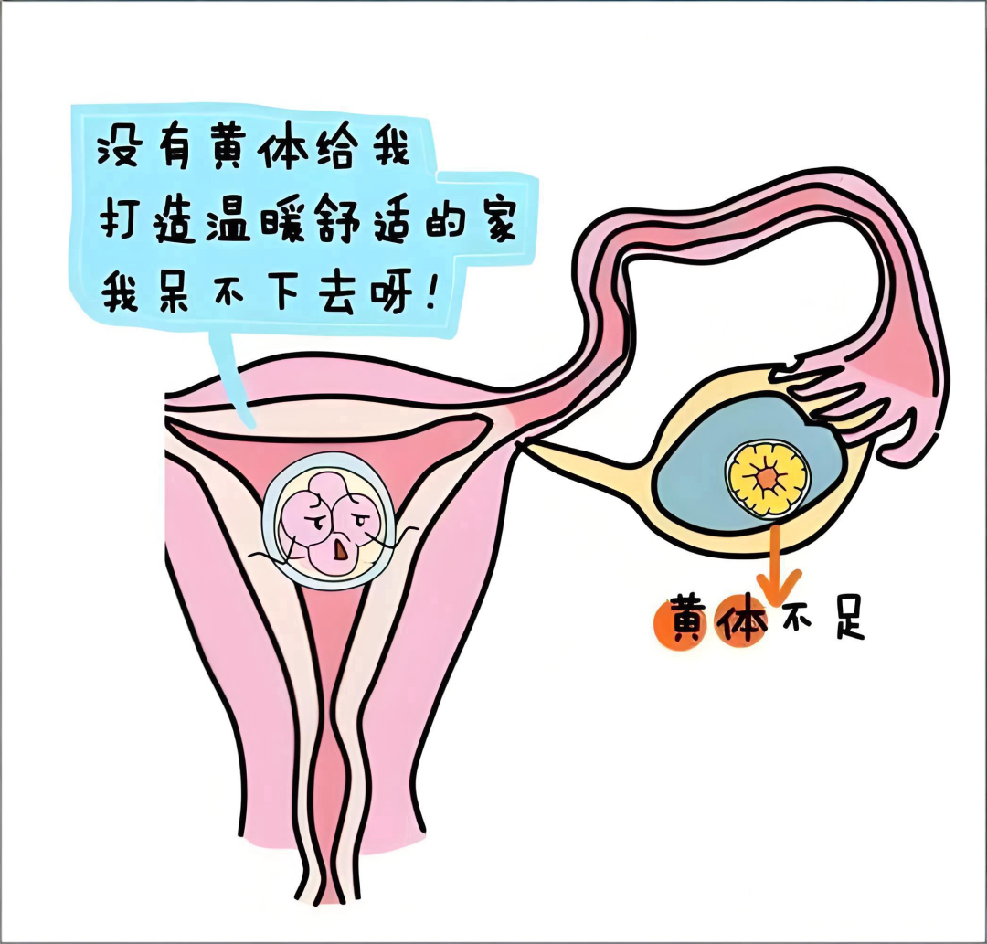黄体支持有哪些方式？试管婴儿移植后为什么必须进行黄体支持？